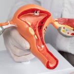 gimdos kaklelio vėžys_ovelia_versli mama