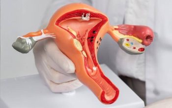 gimdos kaklelio vėžys_ovelia_versli mama