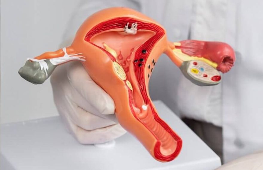 gimdos kaklelio vėžys_ovelia_versli mama